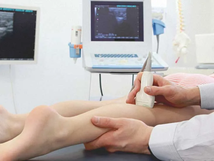 leg vein ultrasound