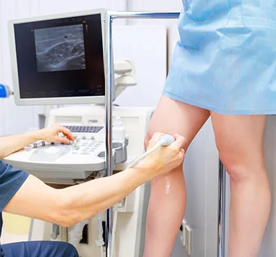 varicose veins ultrasound