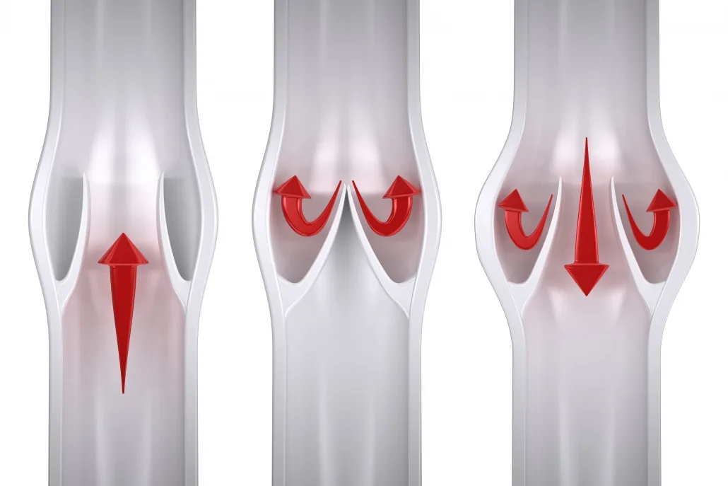 leaky valves in legs