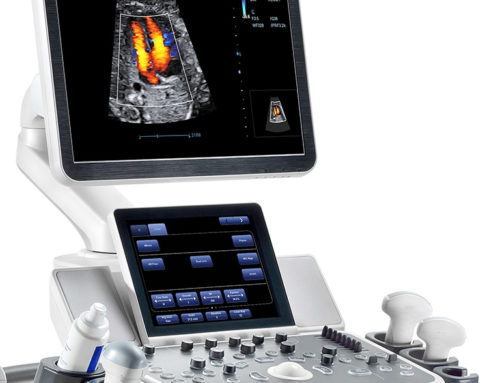 How Ultrasound Can Detect Hidden Dangers in Leg Veins