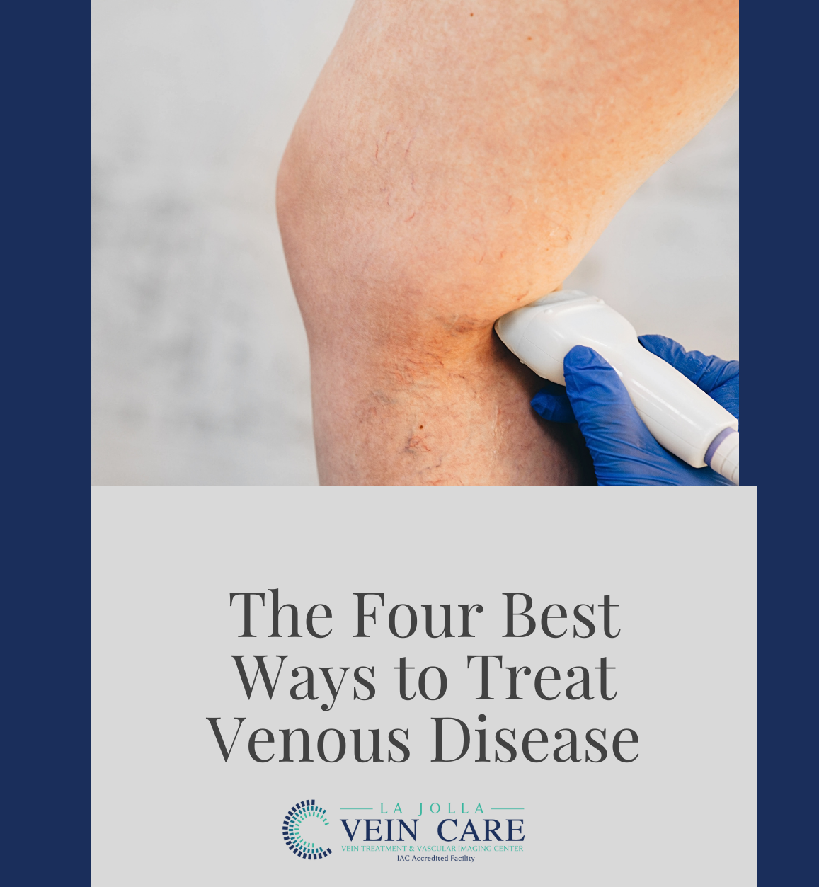 venous disease treatment