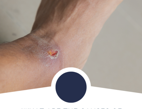 What are the causes of non healing ulcers and wounds?