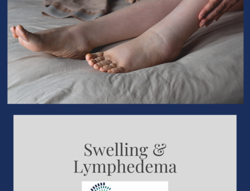 Swelling and Lymphedema