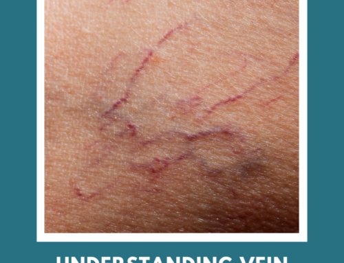 Understanding Vein Disease