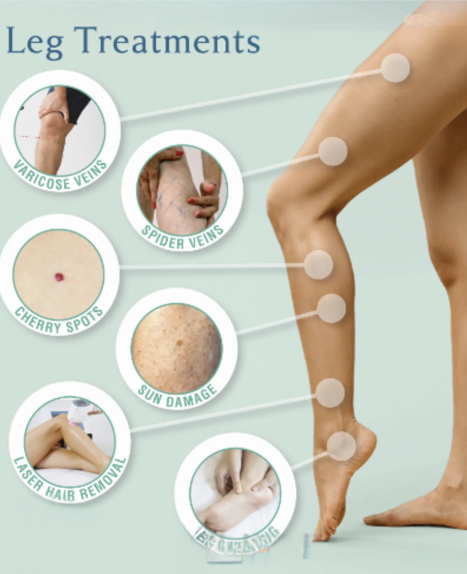 laset leg