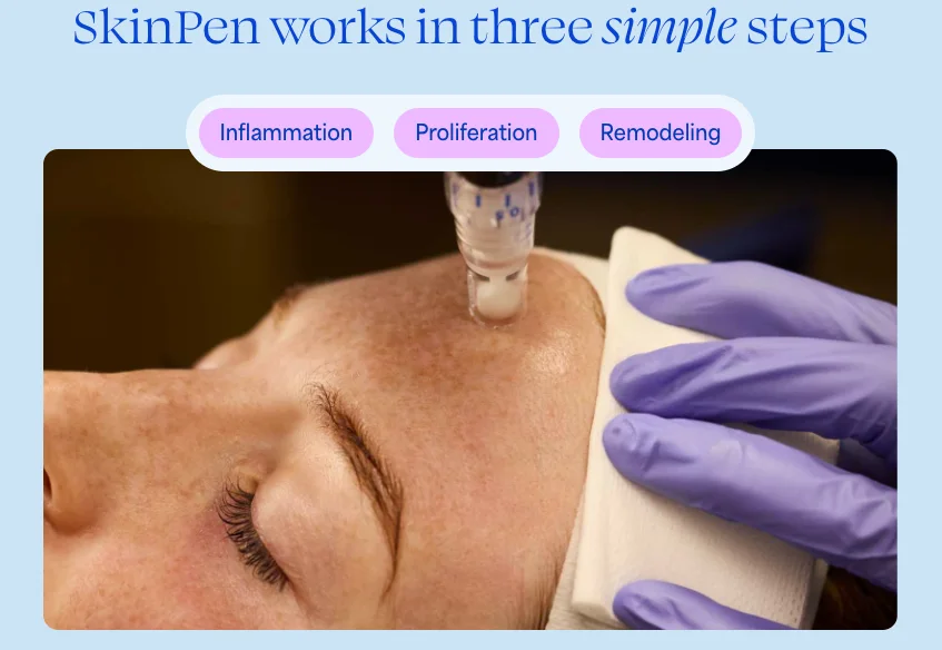 skinpen