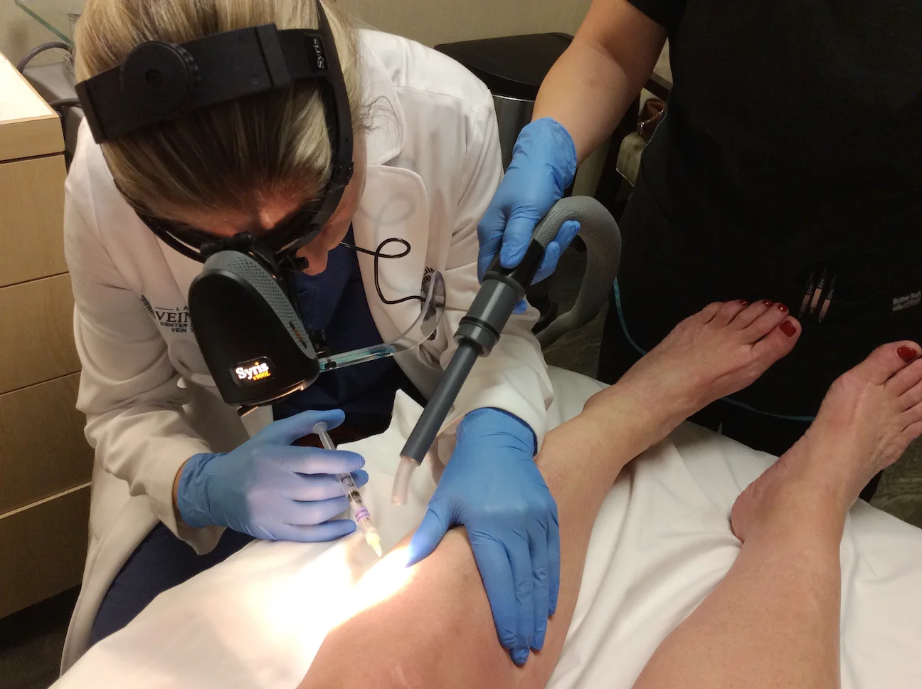 using cryo sclerotherapy for spider vein removal on patients leg